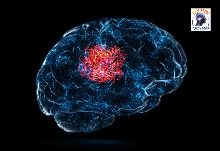 Patient information about a brain tumour consultation with Dr. Shri Ram Gupta