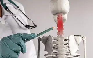 Illustrative image for Cervical Spine Problems patient information