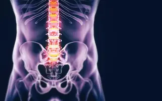 Illustrative image for Spinal Tumour patient information