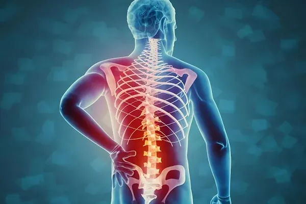 Spine and torso illustration accompanying spinal tuberculosis information